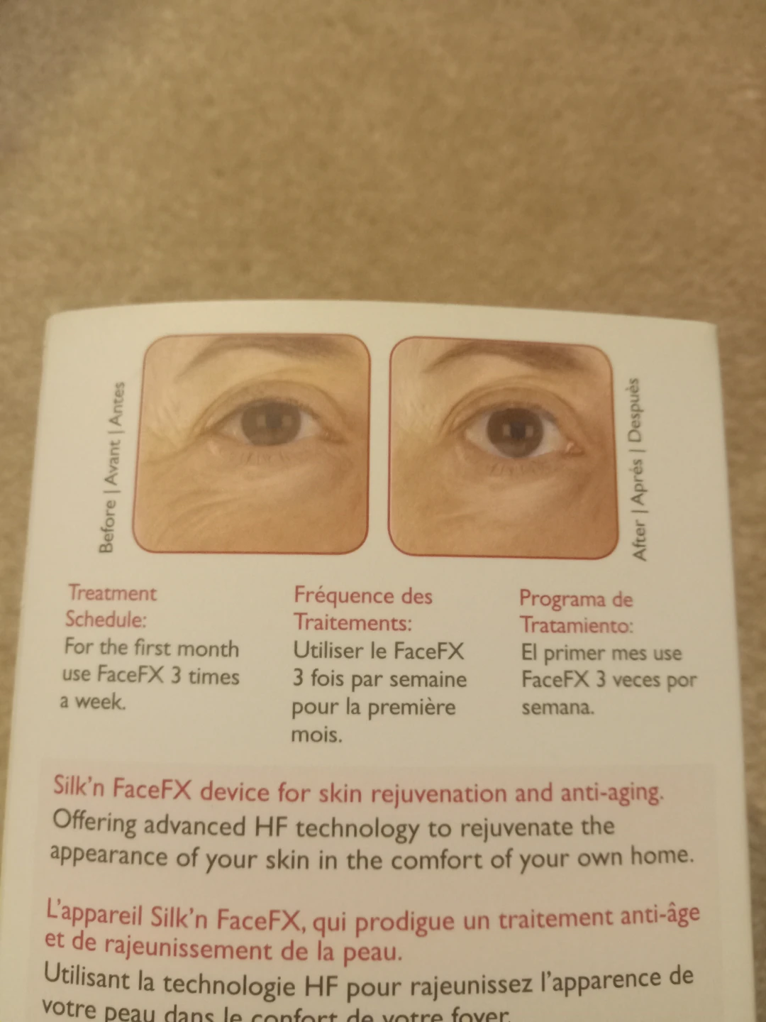 Silk'n FaceFX Anti-Aging Skin Rejuvenation Device - photo 3