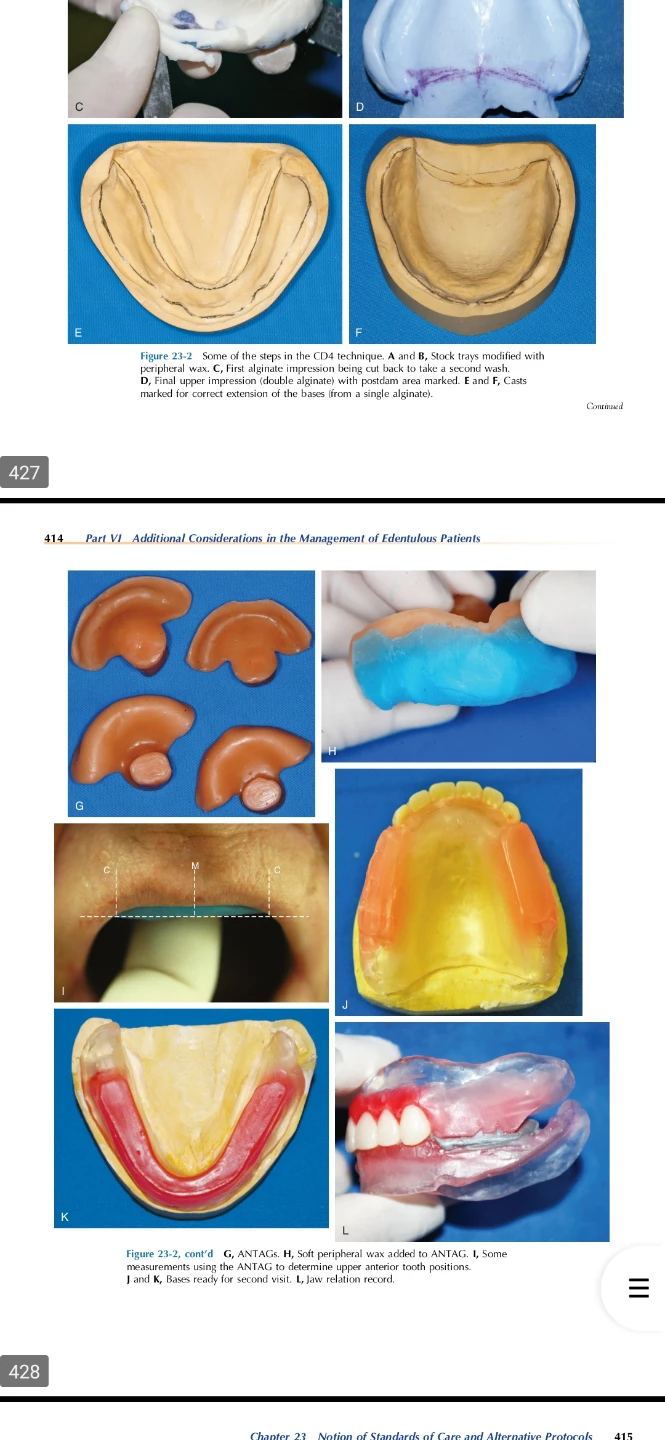 🦷  Prosthodontic Treatment for Edentulous Patients - 13th Edi - photo 3