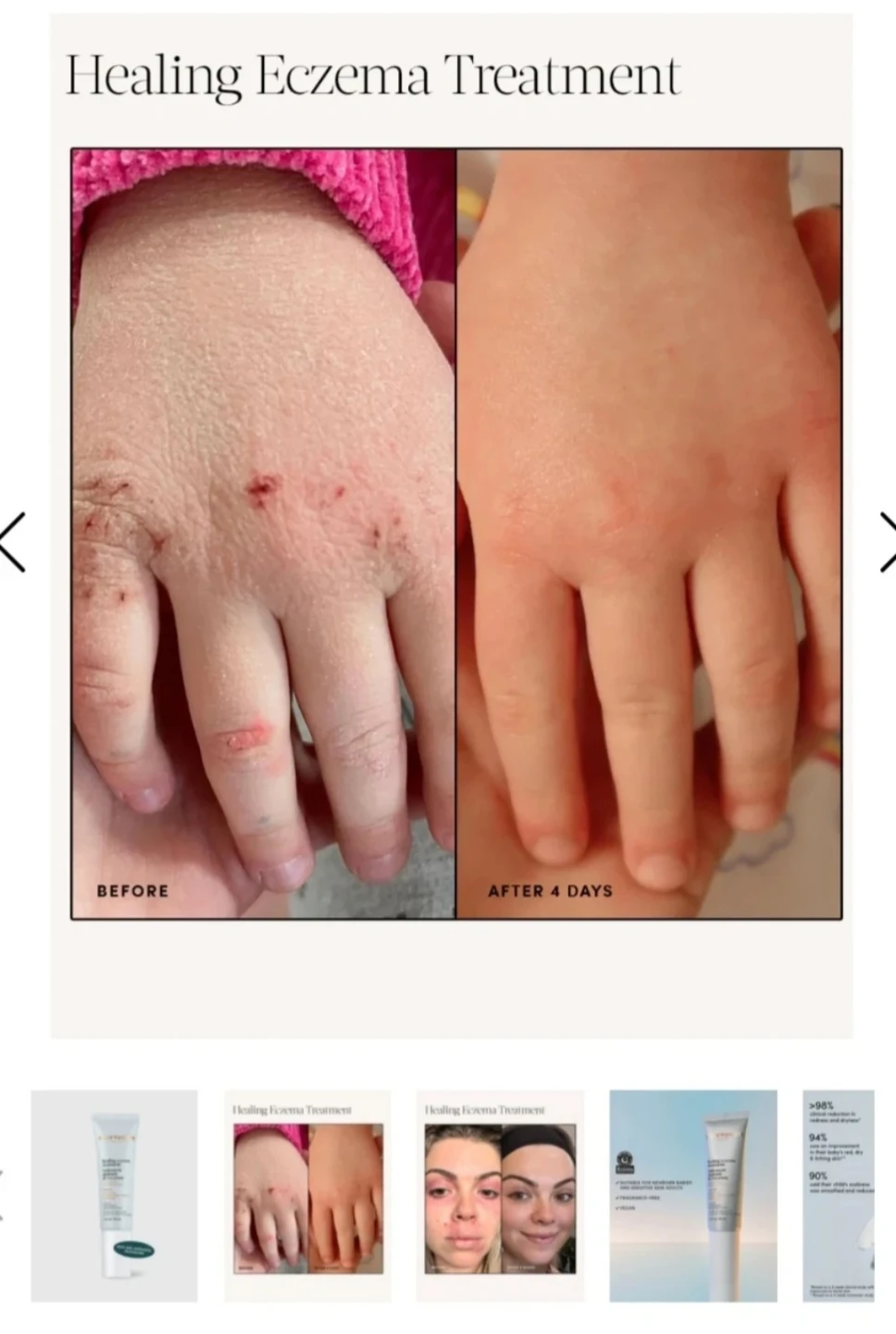 Eczema Relief Cream