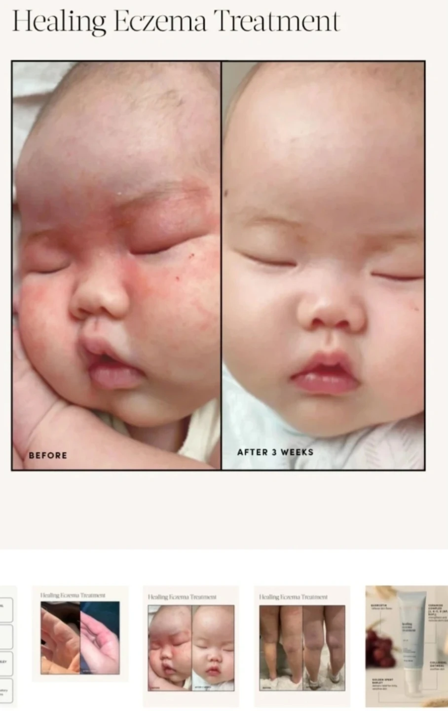 Eczema Relief Cream - photo 3