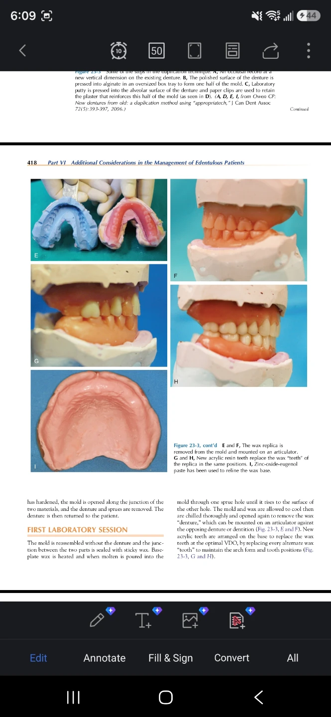 🦷  Prosthodontic Treatment for Edentulous Patients - 13th Edi - photo 2