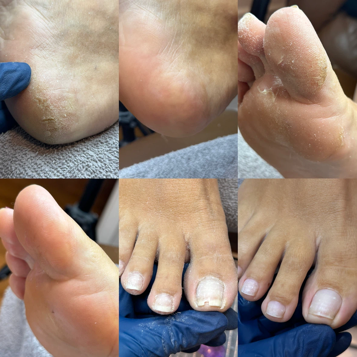 Shellac - photo 3