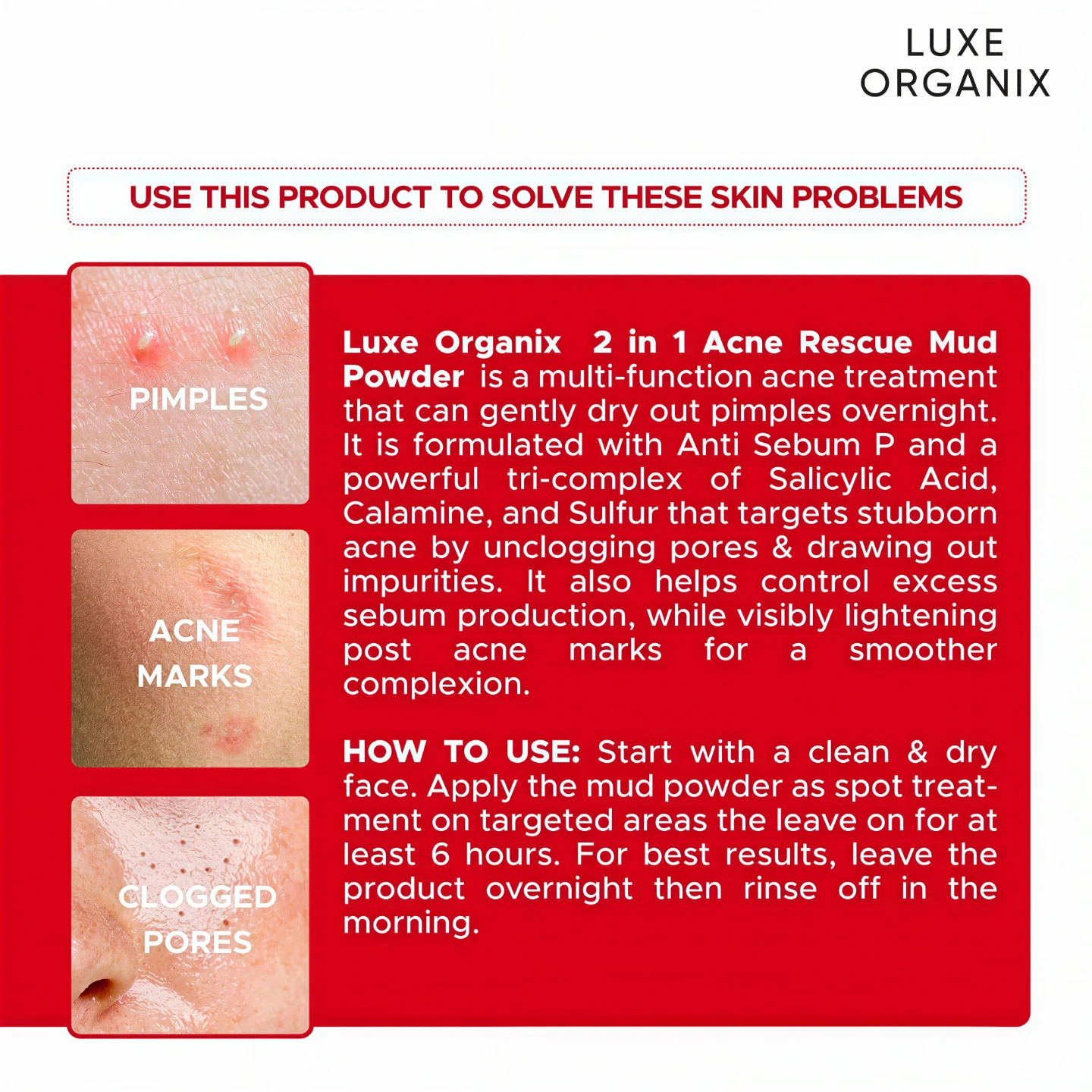 2 in 1 Acne Solution Mud Powder Overnight Pimple Treatment 9g - photo 4