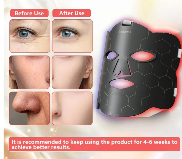 Hottoerak LED Light Therapy Mask - photo 3