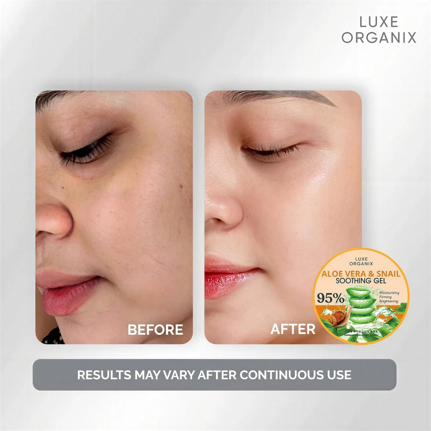 LUXE ORGANIX Snail & Aloe Soothing Gel 300ml - photo 3