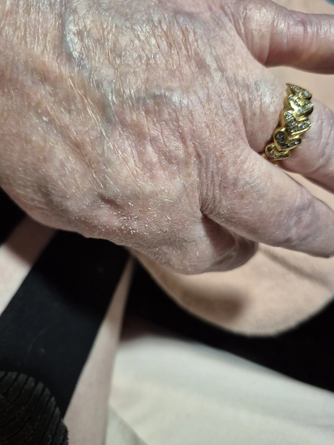 Assorted rings - photo 3