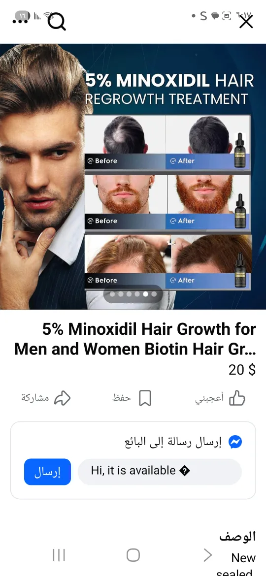 Minoxidil +++ Derma Roller. New.Never used thumbnail