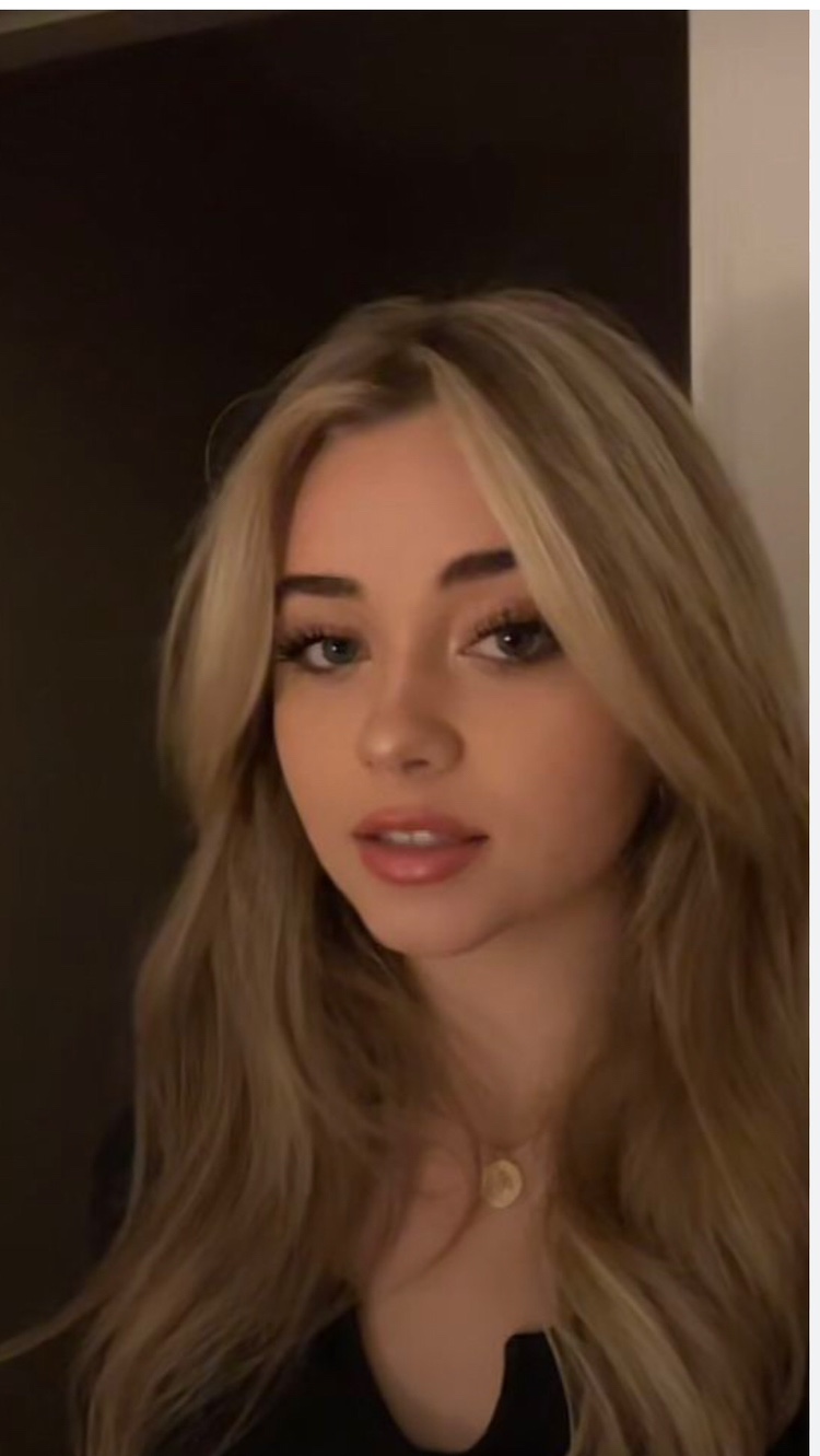Cas J profile
