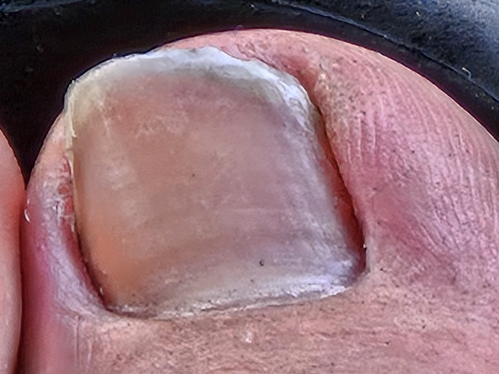 chubbytoe6969 profile