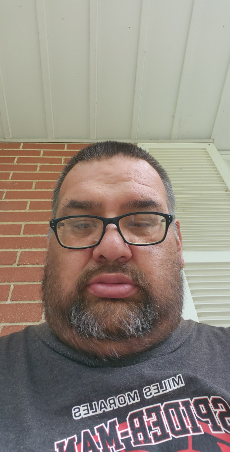 Mike Joseph