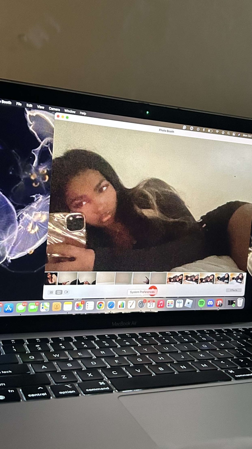Myaa profile
