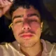 Arvin profile