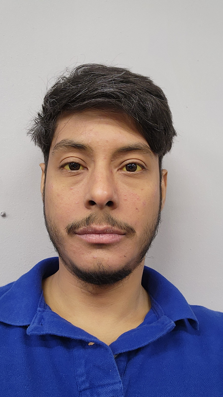 Luis Arguello