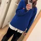 MB profile