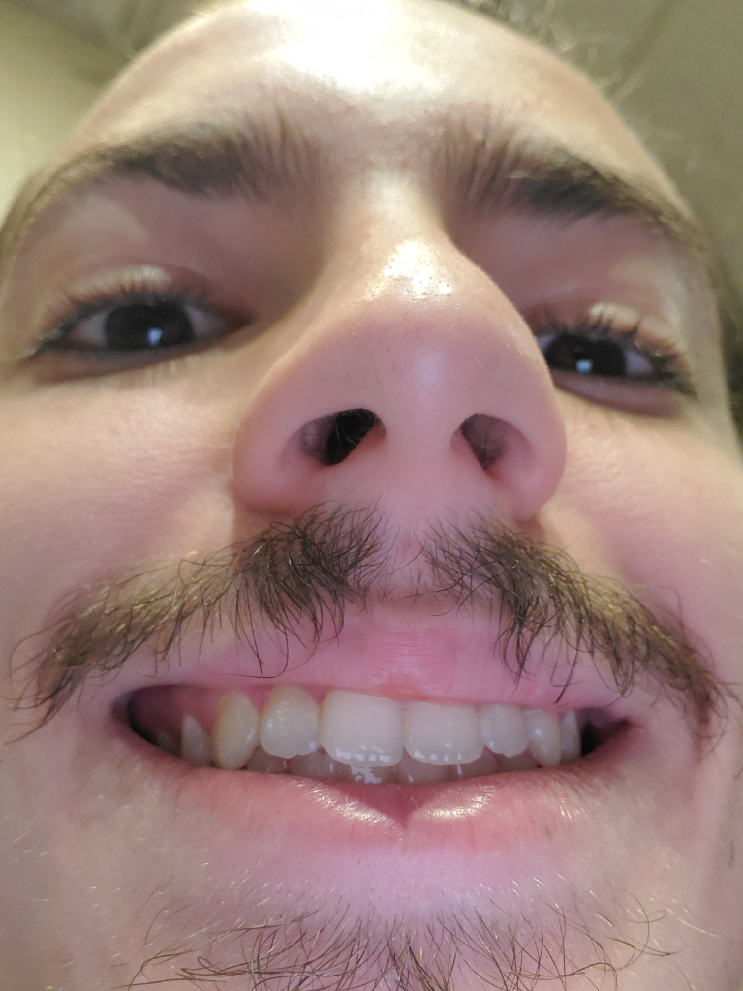 Anthony