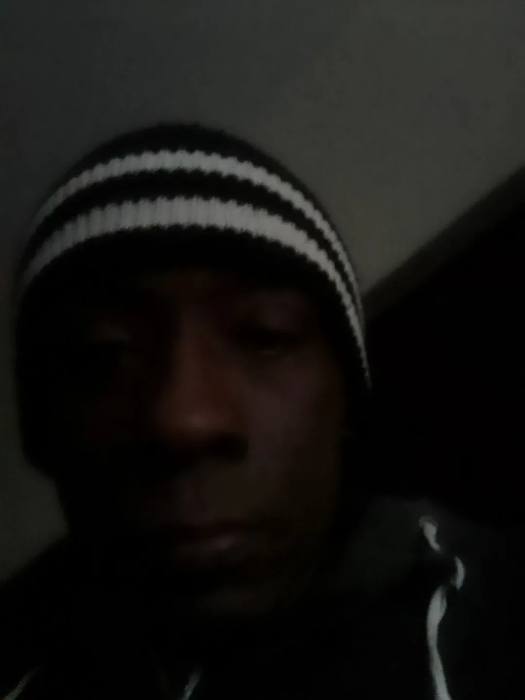 corneal Cordon profile