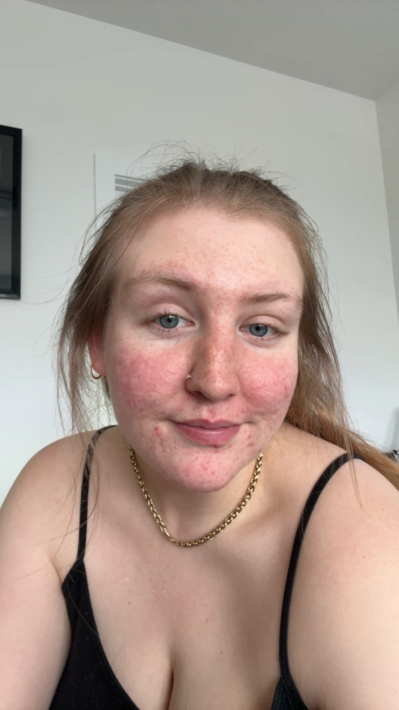 Cassidy profile